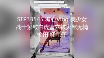 [原创] 已婚同学膝盖操破了【出各大神合集EDC小郎君yqk唐哥猫秦夯呆哥Z先